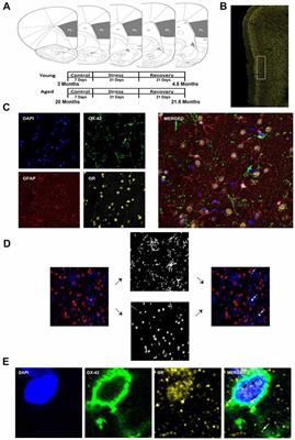Cell-Type Specific Changes in Glial Morphology and Glucocorticoid Expression During Stress and Aging in the Medial Prefrontal Cortex
